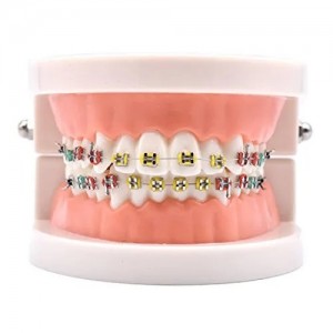 Patient Education Model With Orthodontic Brackets MD-119