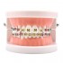 Patient Education Model With Orthodontic Brackets MD-119