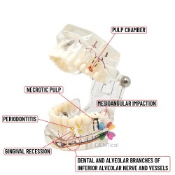 All in one Model Patient Education Model With Nerve 