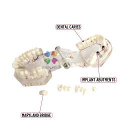 All in one Model Patient Education Model With Nerve 