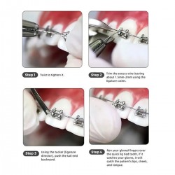 Dental Ligature Wire Spool (50gm)