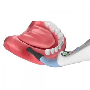 EasyinSmile Smart Implant Detector