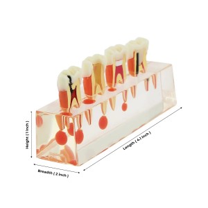 iDENTical Study Model Root Canal Treatment M 4018