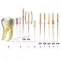 Endodontics Products 