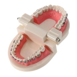 Patient Education Model With Orthodontic Brackets MD-119