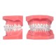 Osstem Orthodontics OK Real Resin With Metal Slot Bracket