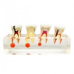 iDENTical Study Model Root Canal Treatment M 4018