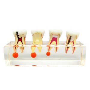 iDENTical Study Model Root Canal Treatment M 4018